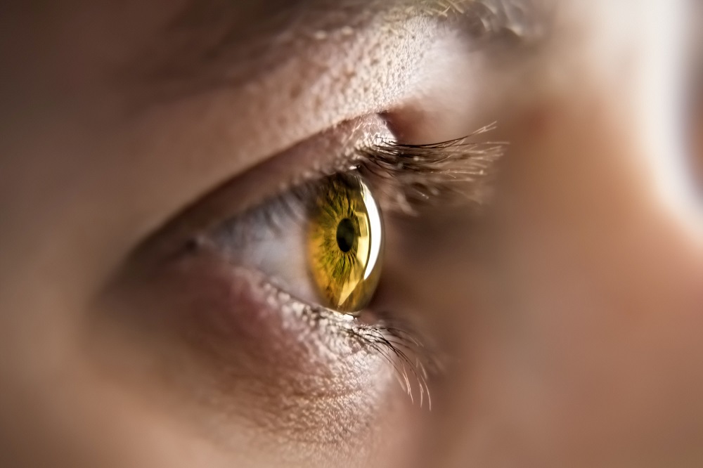 An image of a honey colored eye iris